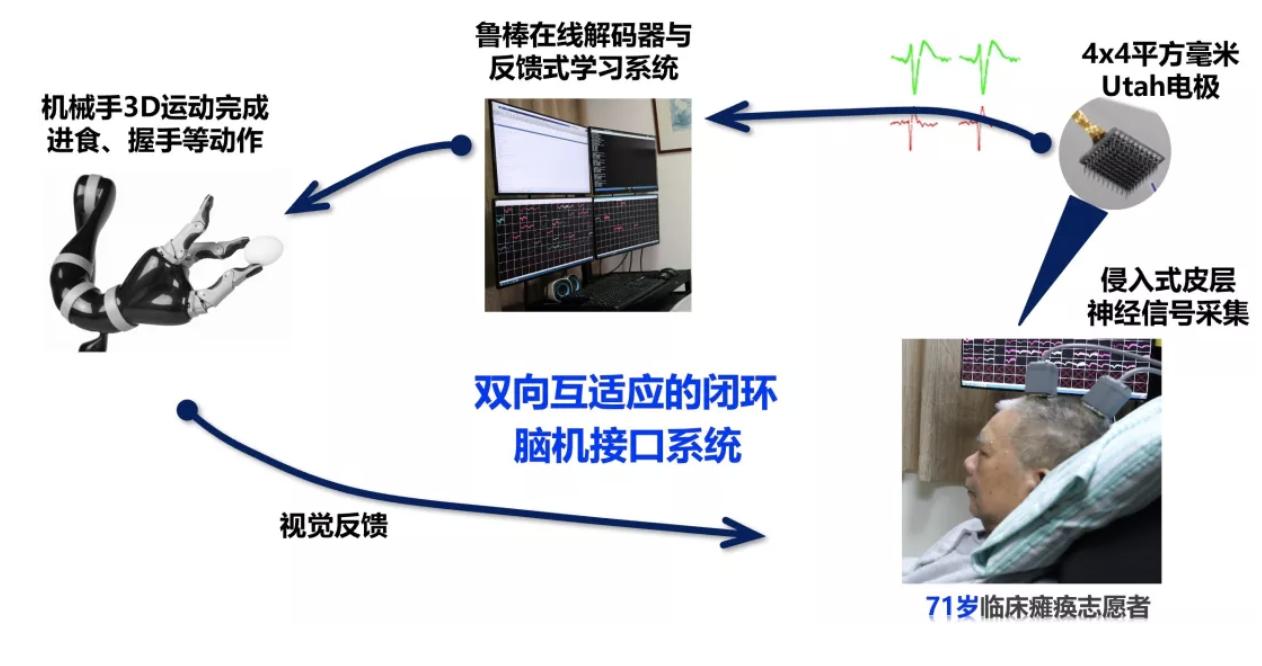 截瘫治疗获重大突破，重塑生活的希望之光